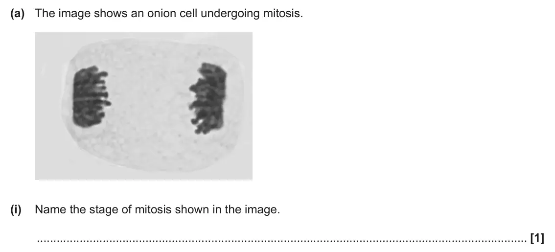 June 2024 Paper 2, question 21(a)(i): Name the stage of mitosis shown in the image. [1]