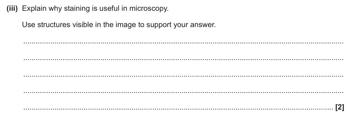 June 2025 Paper 2, question 16(a)(iii): Explain why staining is useful in microscopy. Use structures visible in the image to support your answer. [2]