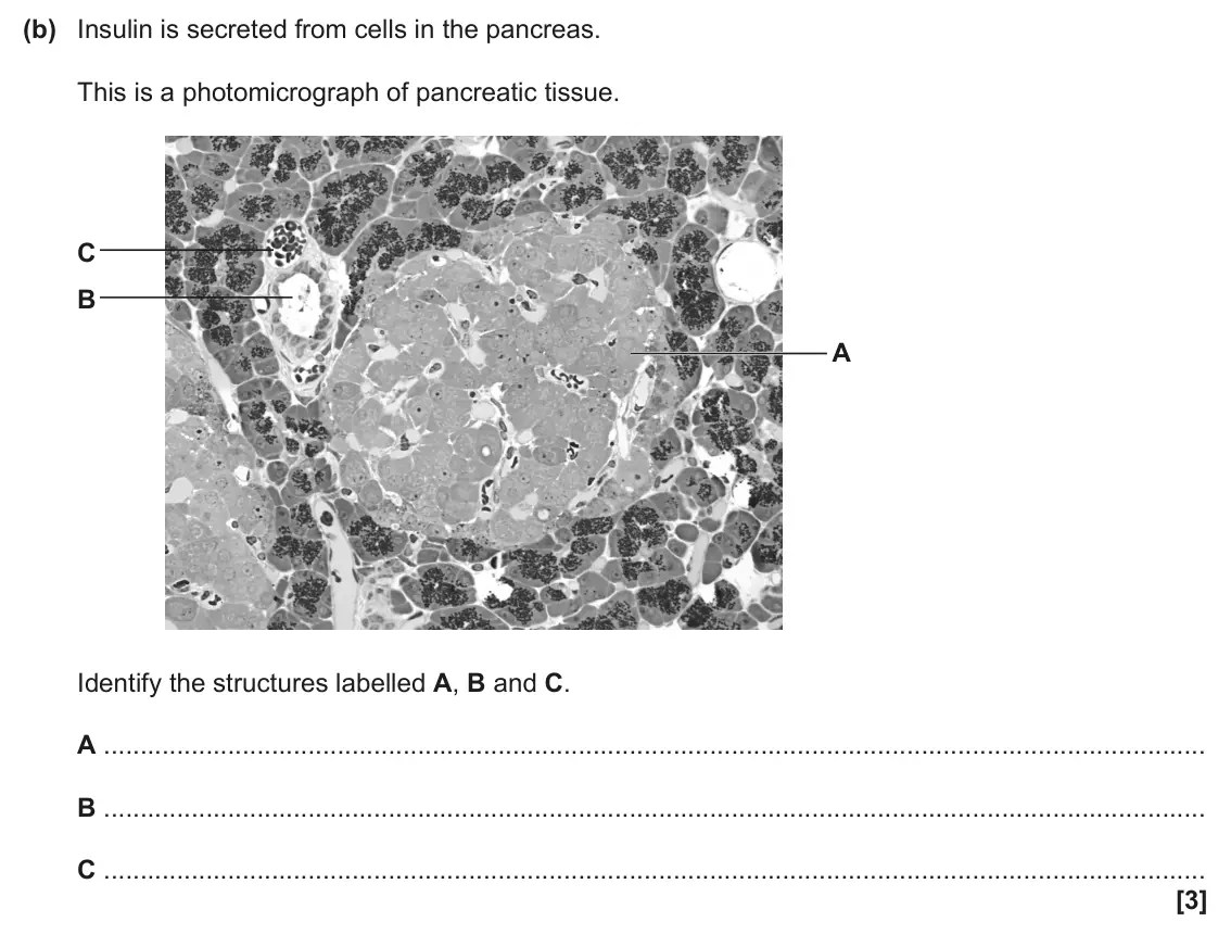 June 2024 Paper 3, question 5(b): Insulin is secreted from cells in the pancreas. This is a photomicrograph of pancreatic tissue. C B A Identify the structures labelled A, B and C. A B C [3]