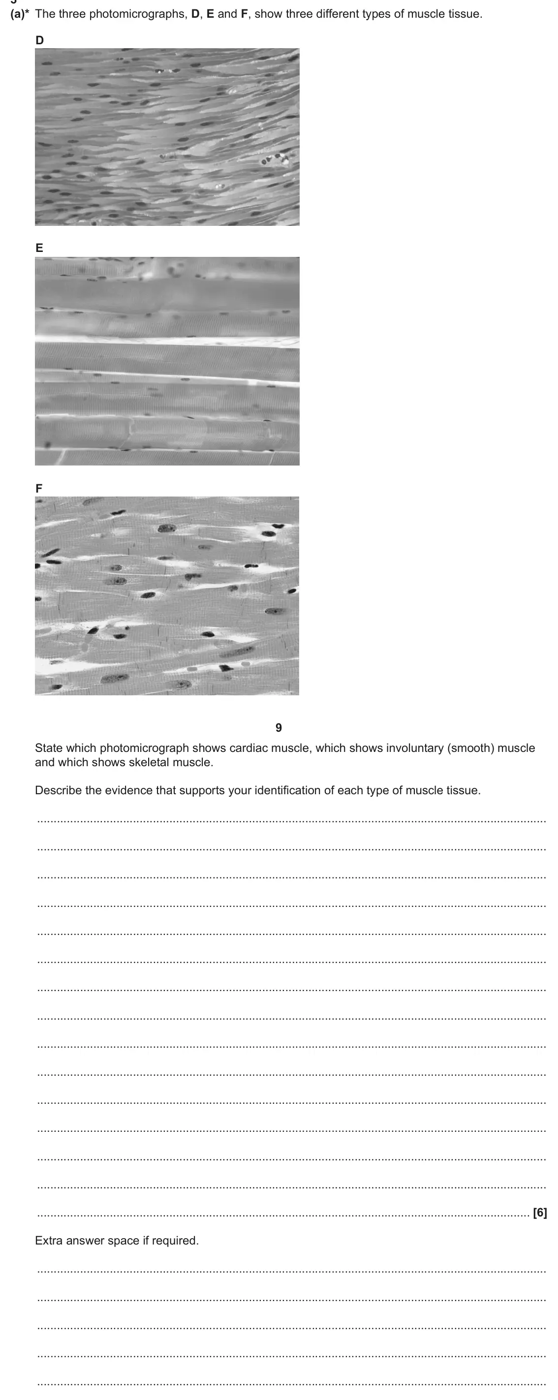 June 2025 Paper 3, question 3(a): (a)* The three photomicrographs, D, E and F, show three different types of muscle tissue. D E F 9 State which photomicrograph shows cardiac muscle, which shows