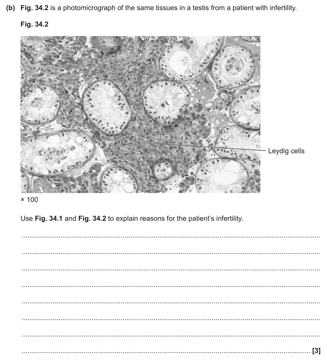 June 2024 Paper 1, question 34(b): Fig. 34.2 is a photomicrograph of the same tissues in a testis from a patient with infertility. Fig. 34.2 Leydig cells × 100 Use Fig. 34.1 and Fig. 34.2 to expl