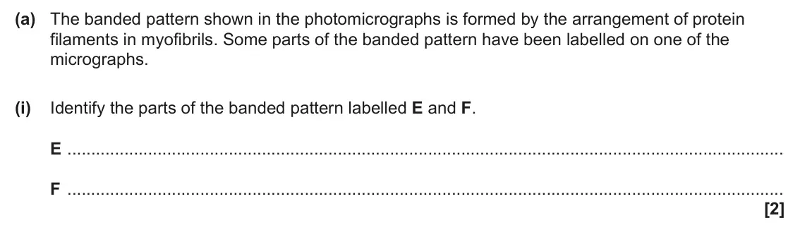 June 2025 Paper 1, question 34(a)(i): Identify the parts of the banded pattern labelled E and F. E F [2]