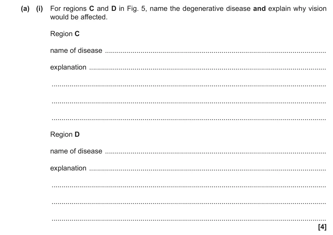 June 2019 Paper 2, question 5(a)(i): For regions C and D in Fig. 5, name the degenerative disease and explain why vision would be affected. Region C name of disease explanation Region D name of dis