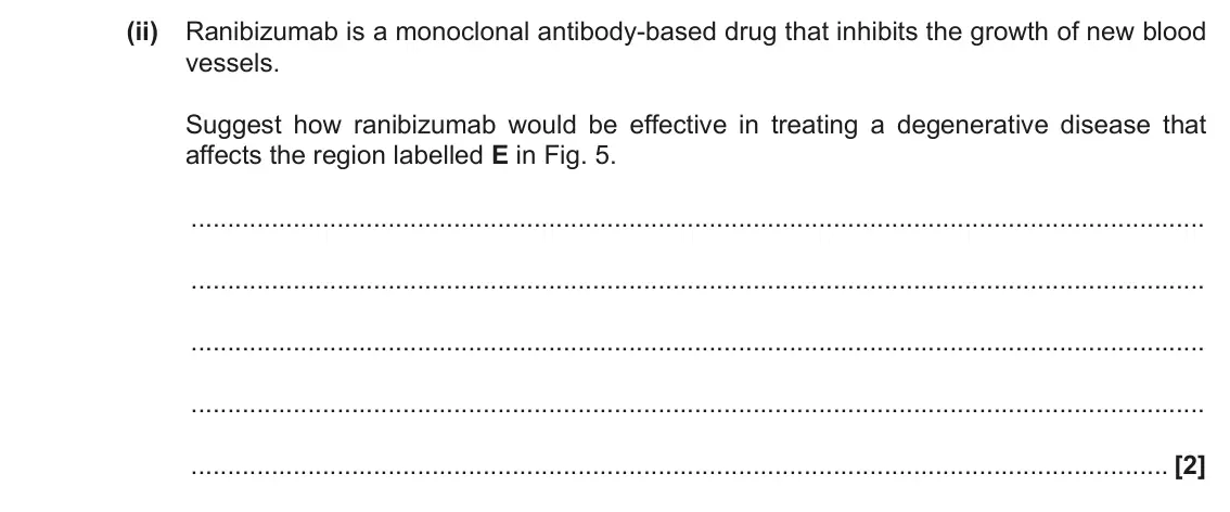 June 2019 Paper 2, question 5(a)(ii): Ranibizumab is a monoclonal antibody-based drug that inhibits the growth of new blood vessels. Suggest how ranibizumab would be effective in treating a degenera