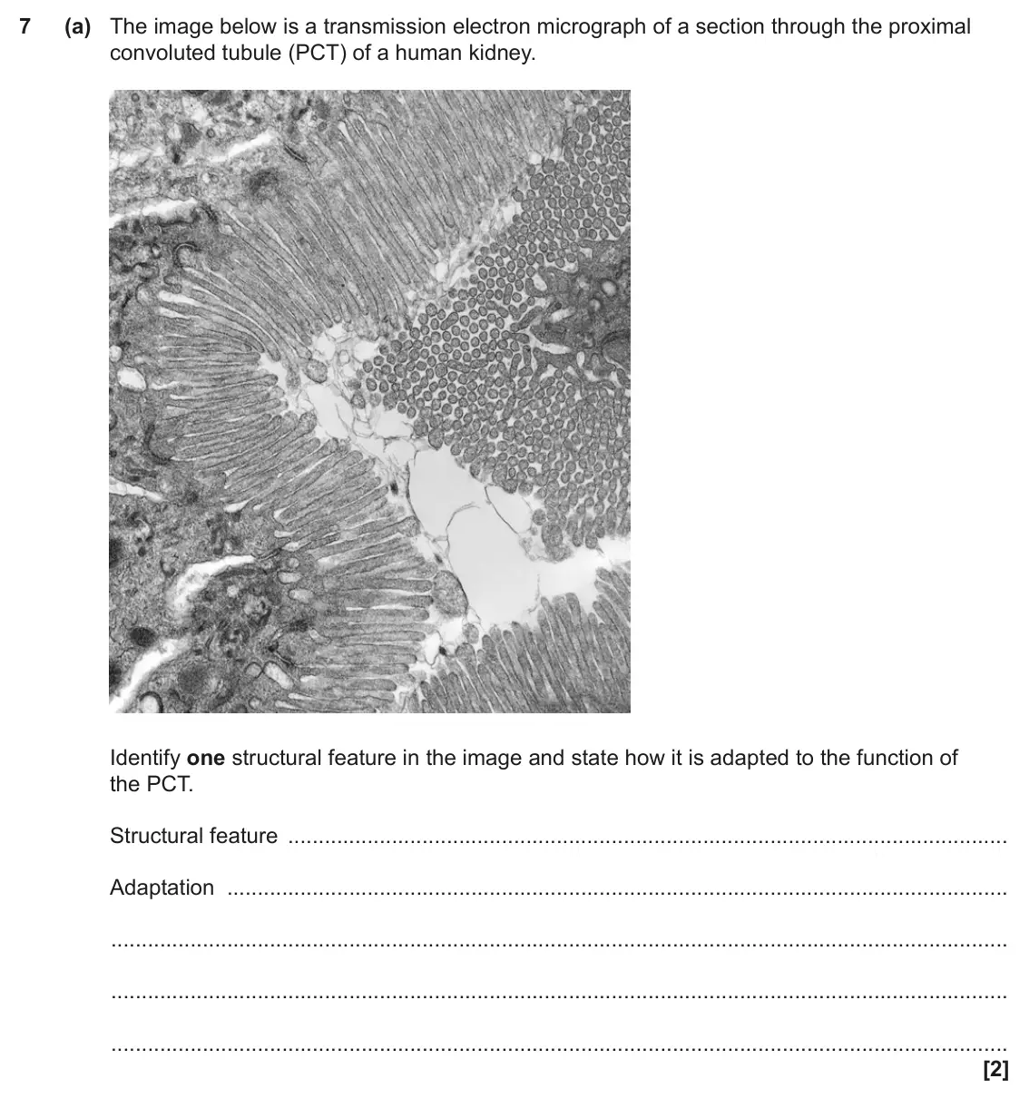 June 2022 Paper 2, question 7(a): The image below is a transmission electron micrograph of a section through the proximal convoluted tubule (PCT) of a human kidney. Identify one structural featu