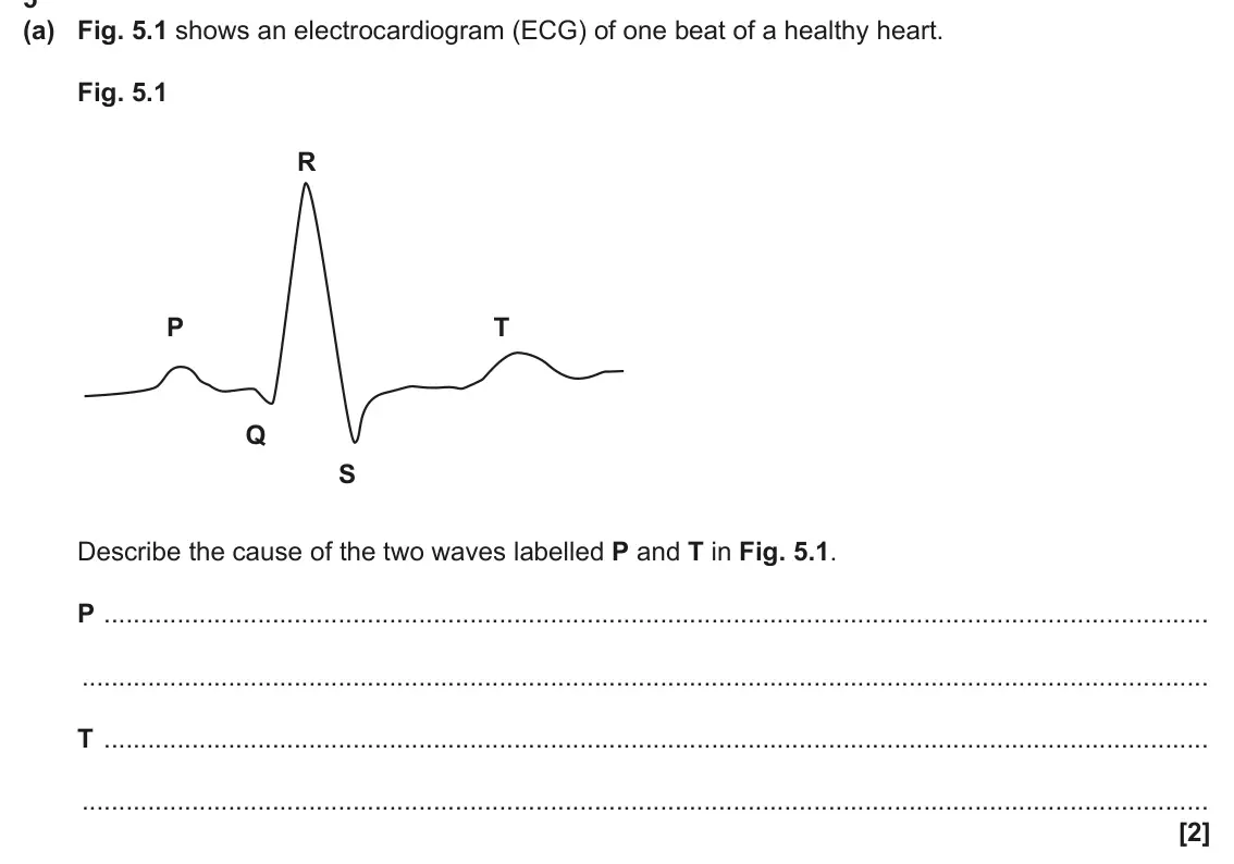 June 2024 Paper 2, question 5(a): Fig. 5.1 shows an electrocardiogram (ECG) of one beat of a healthy heart. Fig. 5.1 R P T Q S Describe the cause of the two waves labelled P and T in Fig. 5.1. P