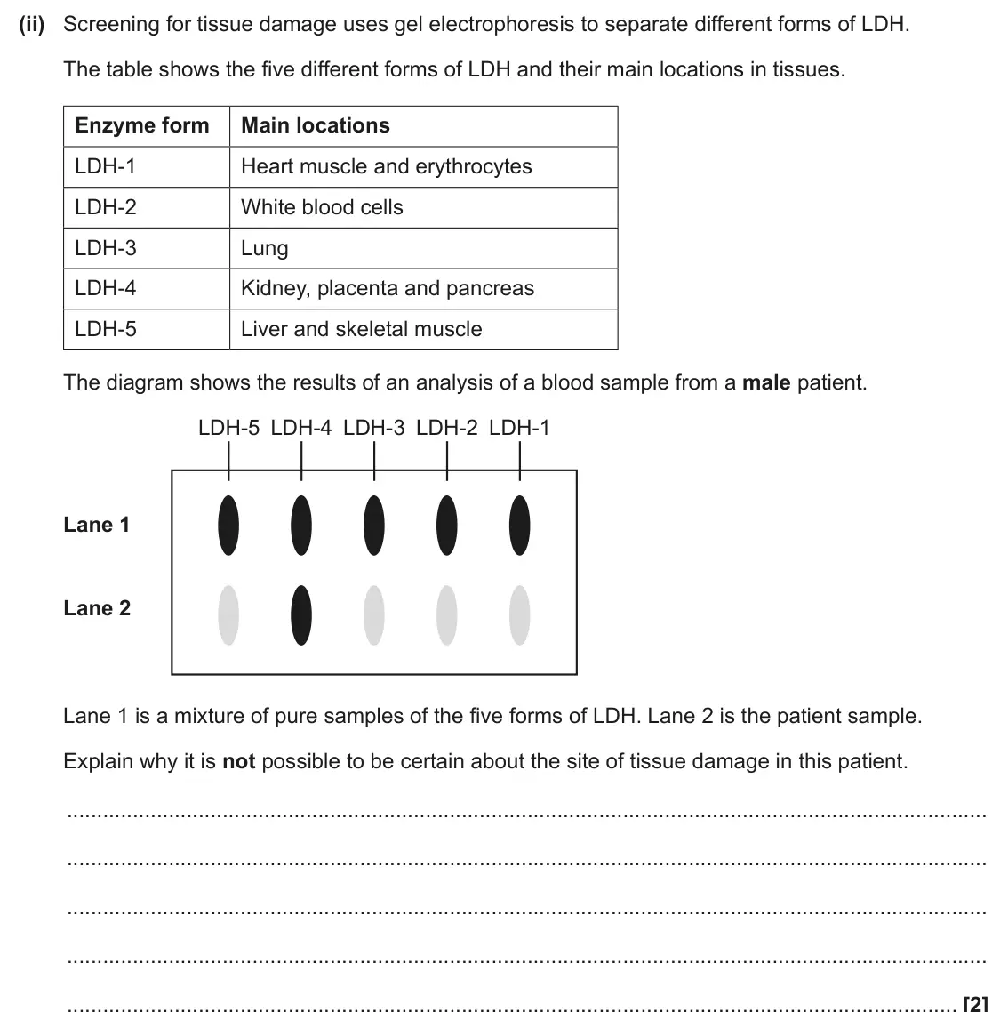 June 2025 Paper 2, question 2(b)(ii): Screening for tissue damage uses gel electrophoresis to separate different forms of LDH. The table shows the five different forms of LDH and their main location