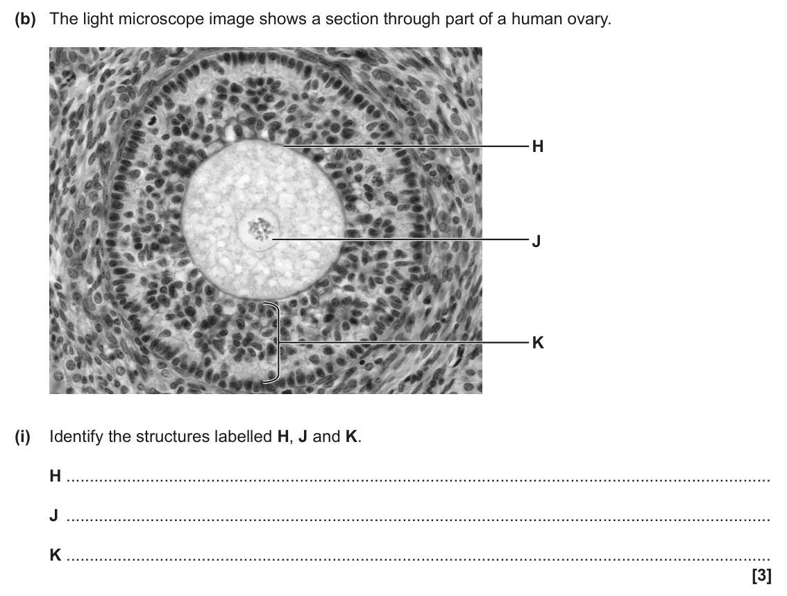 June 2025 Paper 2, question 5(b)(i): Identify the structures labelled H, J and K. H J K [3]