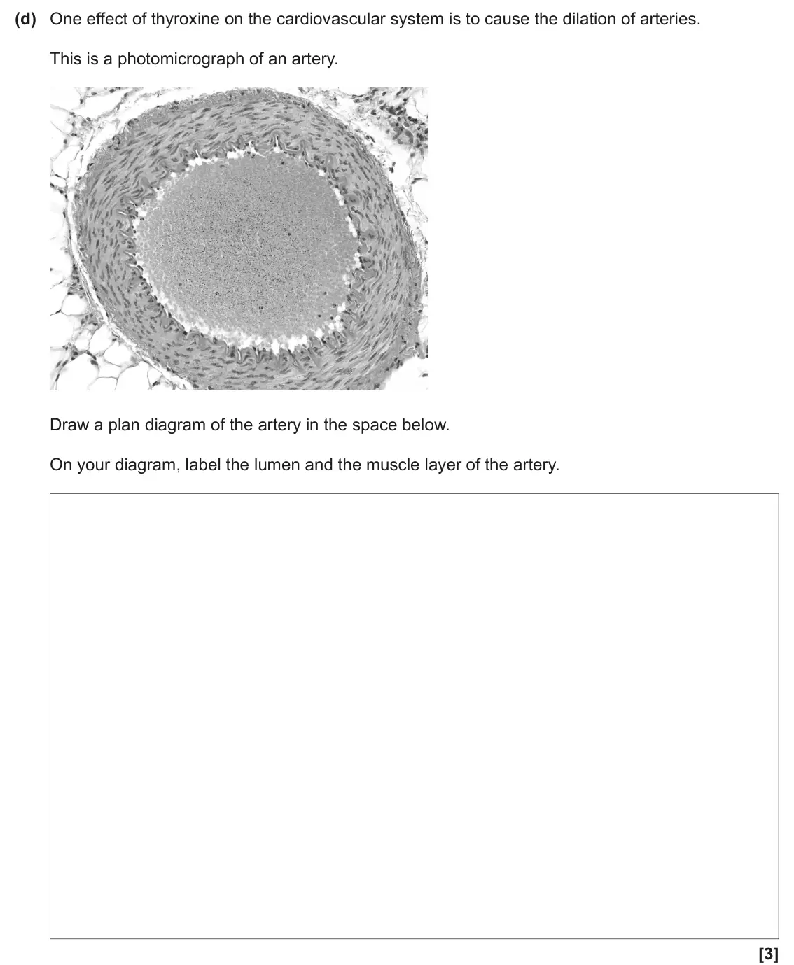 June 2024 Paper 3, question 3(d): One effect of thyroxine on the cardiovascular system is to cause the dilation of arteries. This is a photomicrograph of an artery. Draw a plan diagram of the ar